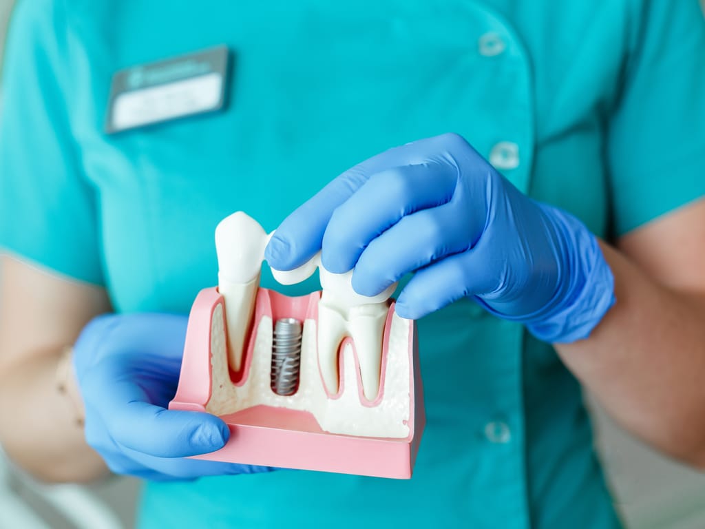 assistante dentaire montrant principe implant dentaire